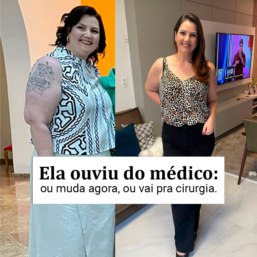 Antes e depois de paciente com transformação corporal